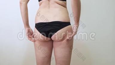 女人用脂肪团裹着她的肥臀，展示着挂着的脂肪